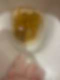 うんこが変わらずもりもり出てる?おしっこも?